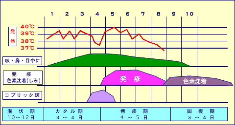 麻疹の経過