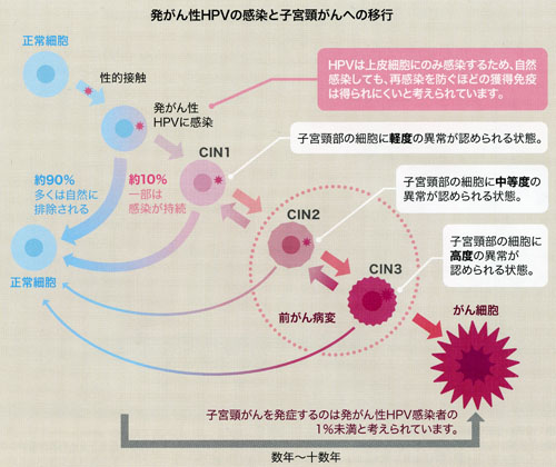 HPV感染の経過